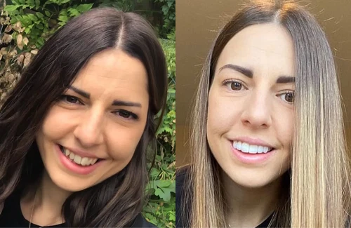 Confronto del sorriso, esempio 2